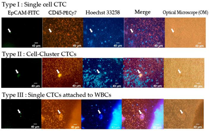 https://cdn.ncbi.nlm.nih.gov/pmc/blobs/1473/8151024/4fa0d4c28c93/cells-10-01149-g006.jpg