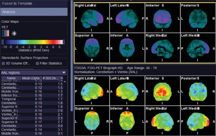 https://cdn.ncbi.nlm.nih.gov/pmc/blobs/1478/12121842/386939234578/IJNM-40-22-g002.jpg