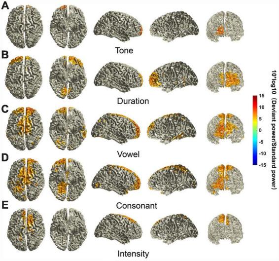 https://cdn.ncbi.nlm.nih.gov/pmc/blobs/147c/10804857/77fa87566b25/fnins-17-1277129-g005.jpg