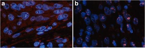 https://cdn.ncbi.nlm.nih.gov/pmc/blobs/147f/5576106/fc86b126ffa8/12885_2017_3586_Fig1_HTML.jpg