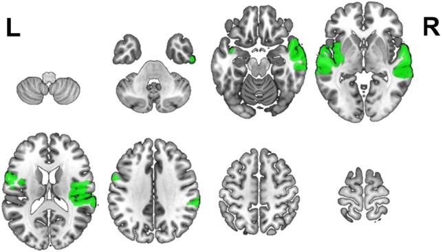 https://cdn.ncbi.nlm.nih.gov/pmc/blobs/1480/10516972/37ca714ddf27/41598_2023_43027_Fig1_HTML.jpg