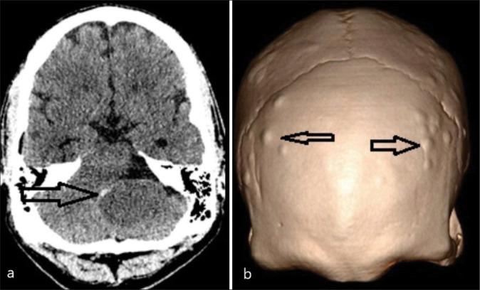 https://cdn.ncbi.nlm.nih.gov/pmc/blobs/1483/11450800/25a679d1bf8f/SNI-15-340-g004.jpg