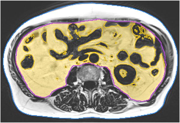 https://cdn.ncbi.nlm.nih.gov/pmc/blobs/1488/12037472/849f97060cbf/fphys-16-1544332-g003.jpg
