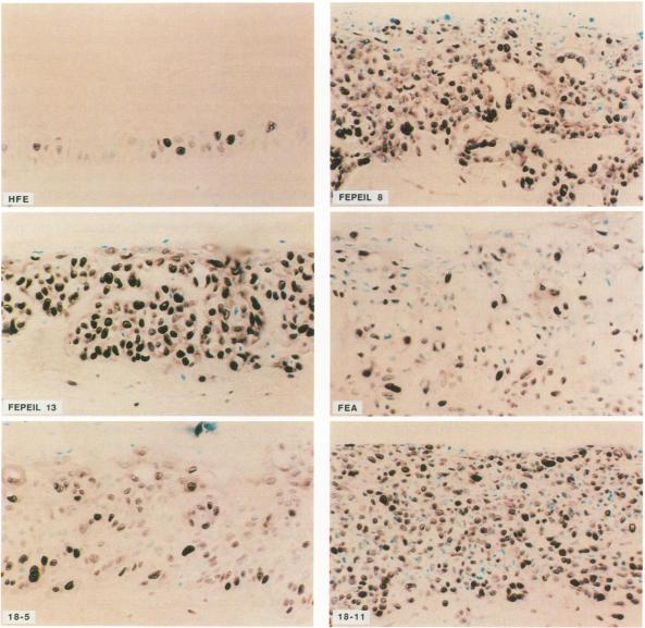 https://cdn.ncbi.nlm.nih.gov/pmc/blobs/1488/1886258/f6c5fe9df663/amjpathol00085-0169-a.jpg