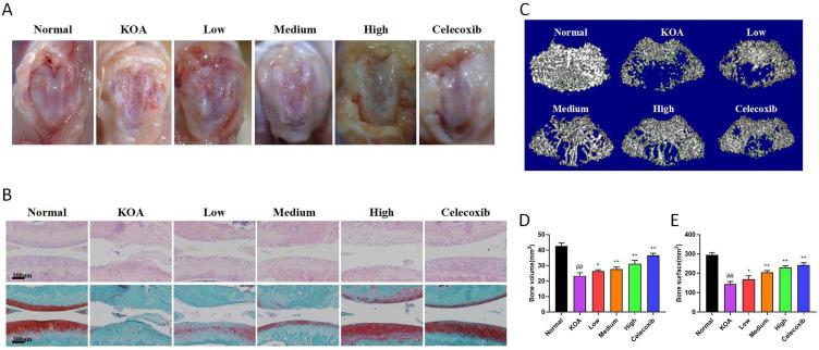 https://cdn.ncbi.nlm.nih.gov/pmc/blobs/148a/11330260/774b9e6e914c/JIR-17-5311-g0004.jpg