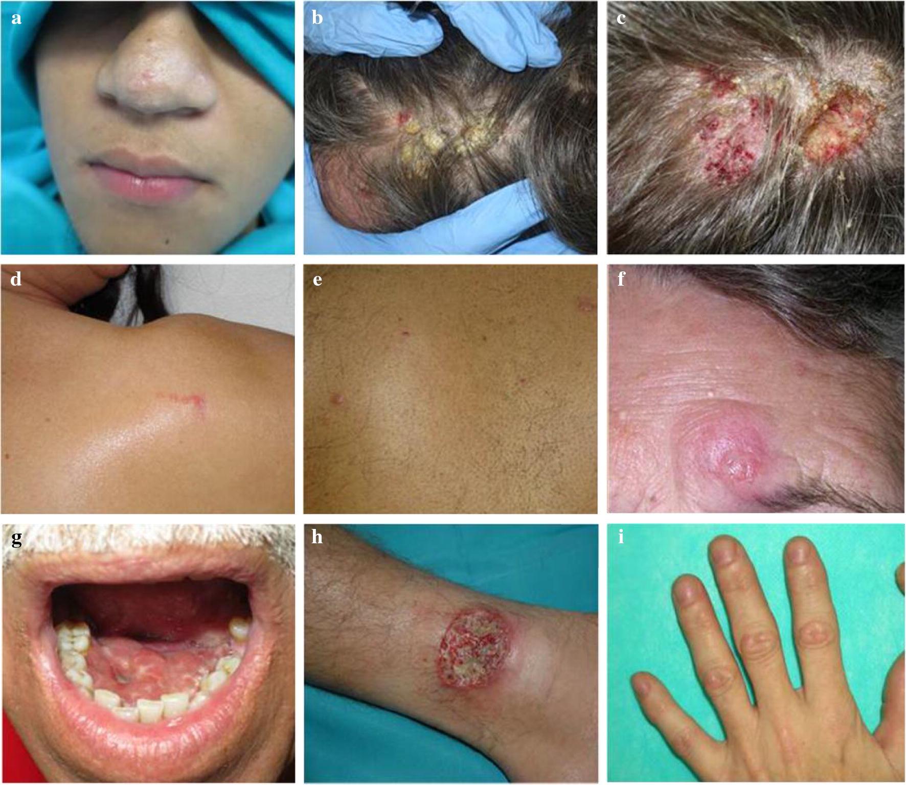 https://cdn.ncbi.nlm.nih.gov/pmc/blobs/148b/6958673/c6c0ffcb4c8b/13071_2020_3901_Fig1_HTML.jpg