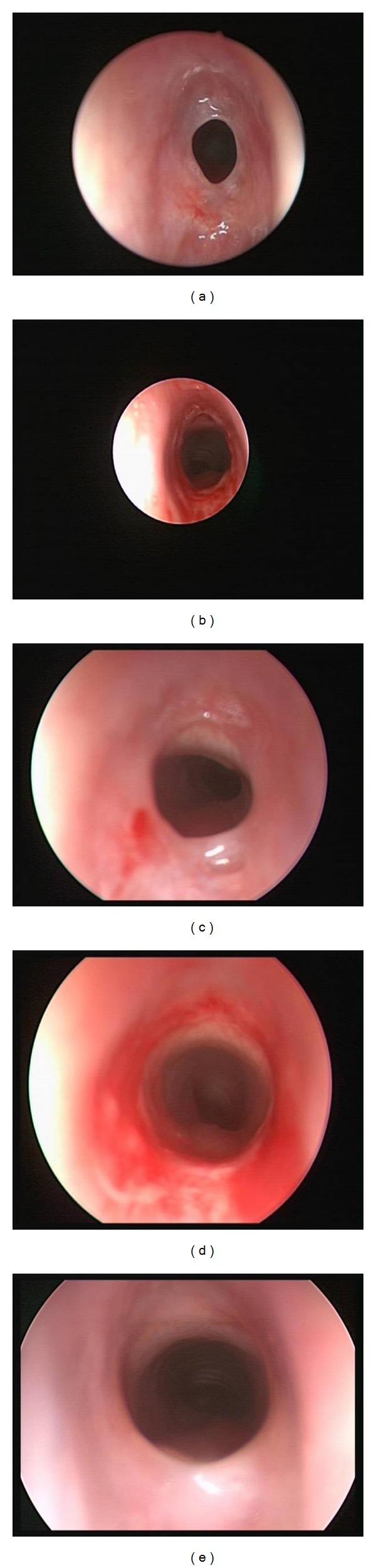 https://cdn.ncbi.nlm.nih.gov/pmc/blobs/148e/3965922/c9c2ebbd0f0c/CRIOT2014-304593.001.jpg