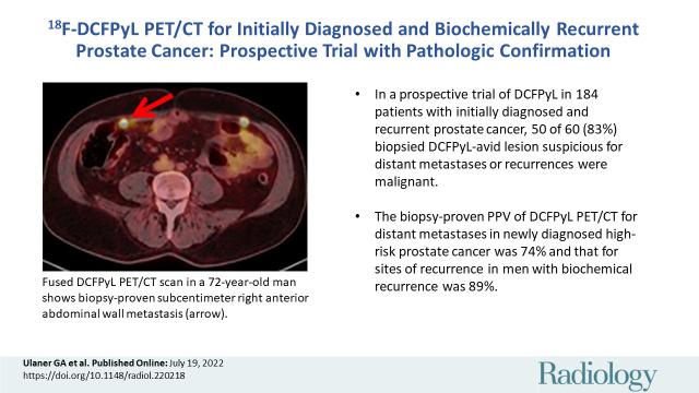 https://cdn.ncbi.nlm.nih.gov/pmc/blobs/148e/9619197/066913758b93/radiol.220218.VA.jpg