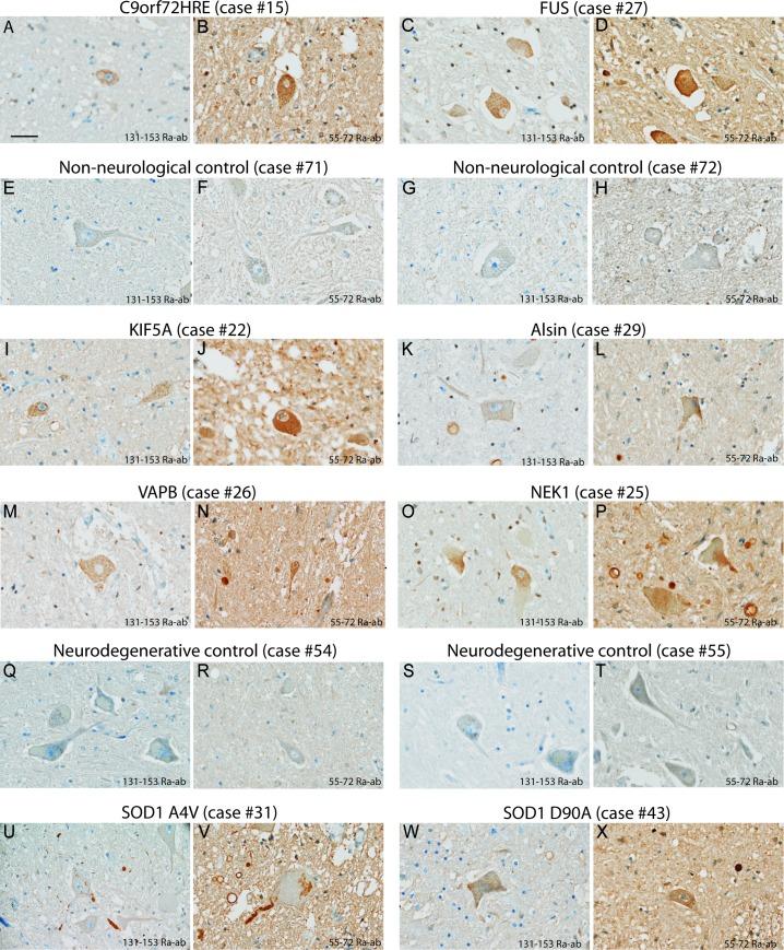 https://cdn.ncbi.nlm.nih.gov/pmc/blobs/1496/6691870/b373f29929cc/jnnp-2018-319386f04.jpg