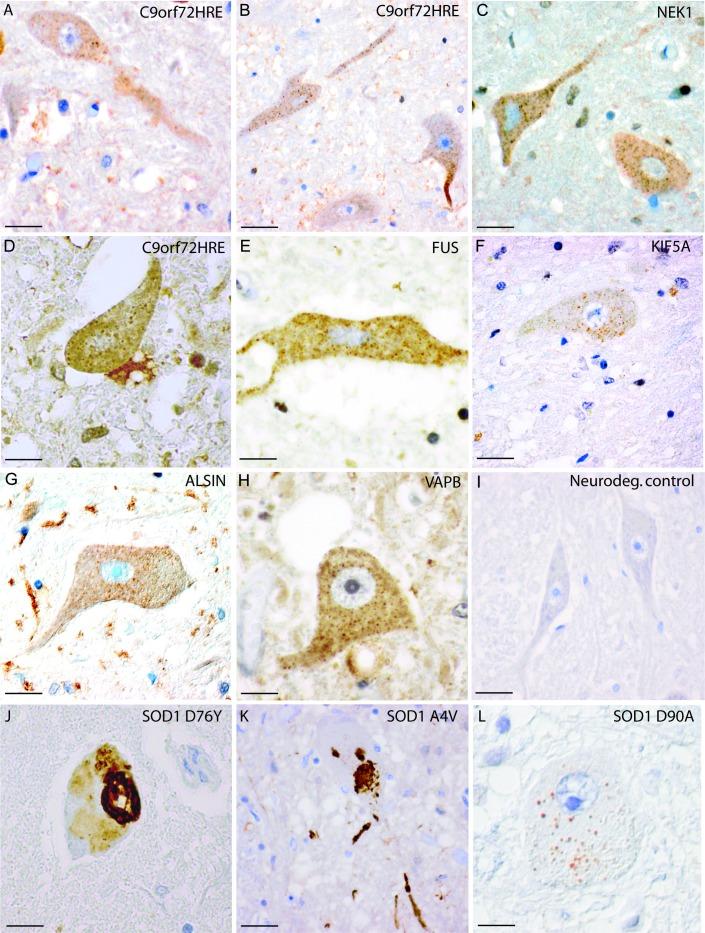 https://cdn.ncbi.nlm.nih.gov/pmc/blobs/1496/6691870/d353fccc4f9d/jnnp-2018-319386f01.jpg