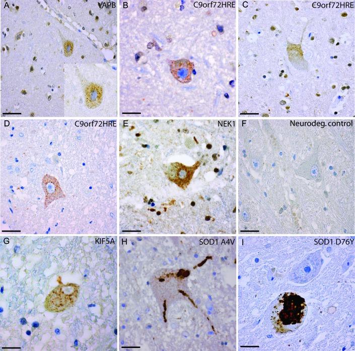 https://cdn.ncbi.nlm.nih.gov/pmc/blobs/1496/6691870/fa999a99172d/jnnp-2018-319386f03.jpg
