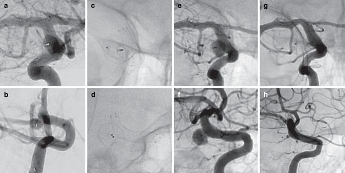 https://cdn.ncbi.nlm.nih.gov/pmc/blobs/14a1/11564379/63b1b26dd818/62_2024_1423_Fig2_HTML.jpg