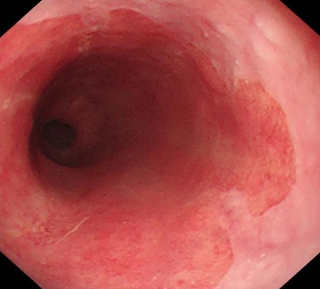 https://cdn.ncbi.nlm.nih.gov/pmc/blobs/14ab/8263447/3ad035599e12/464_2020_7950_Fig3_HTML.jpg