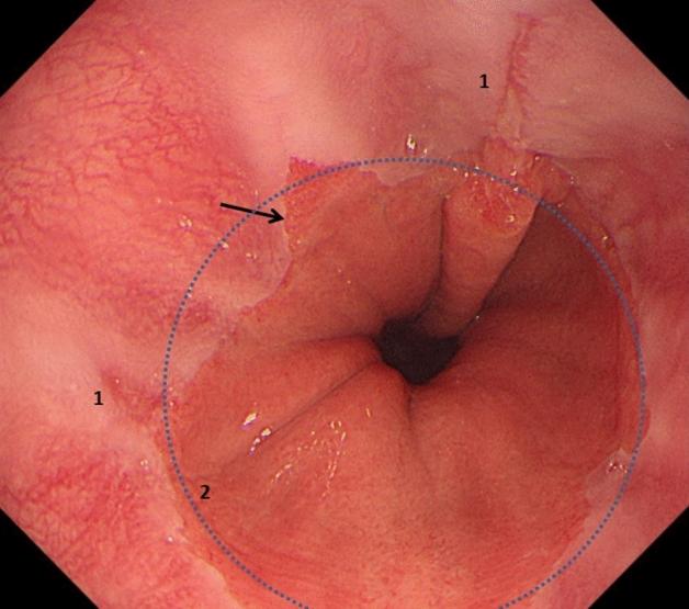 https://cdn.ncbi.nlm.nih.gov/pmc/blobs/14ab/8263447/8fa7a936acf9/464_2020_7950_Fig4_HTML.jpg