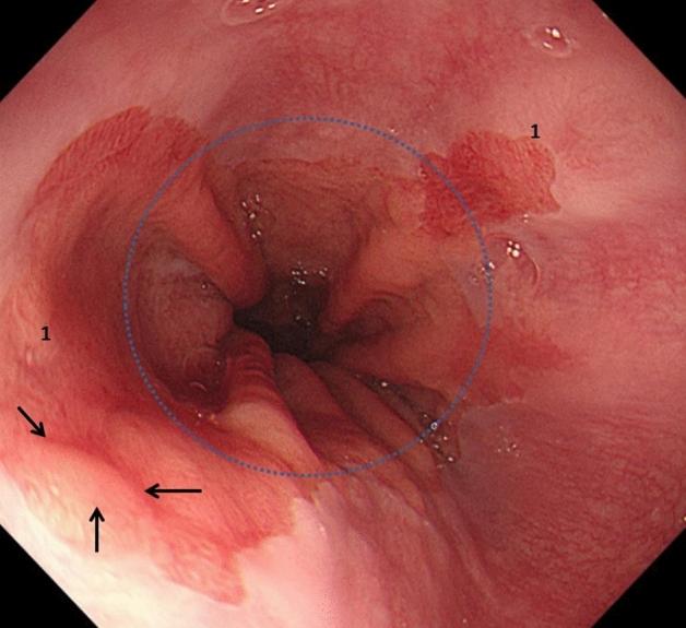https://cdn.ncbi.nlm.nih.gov/pmc/blobs/14ab/8263447/c67e3555a4cb/464_2020_7950_Fig1_HTML.jpg