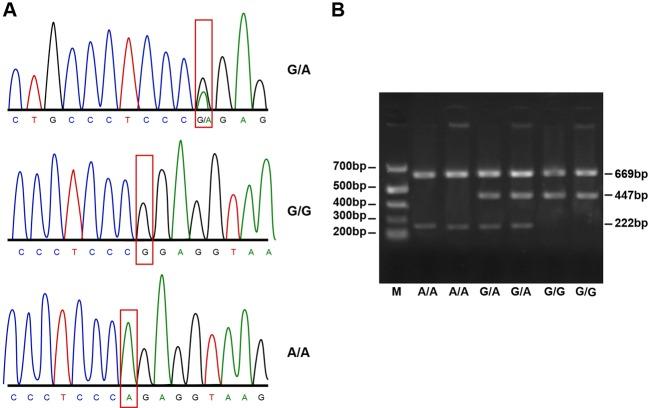 https://cdn.ncbi.nlm.nih.gov/pmc/blobs/14b2/5477560/3eee3e22688d/BSR-2016-0644i003.jpg
