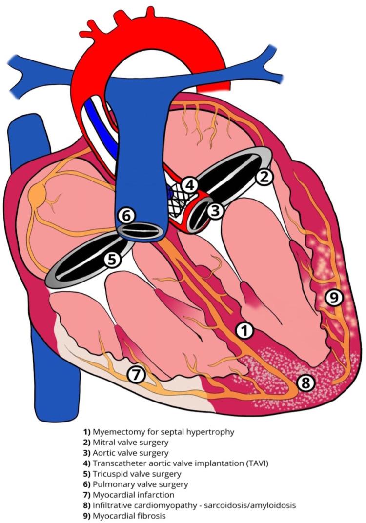 https://cdn.ncbi.nlm.nih.gov/pmc/blobs/14c3/10463741/82a22d33270e/fcvm-10-1220709-g002.jpg