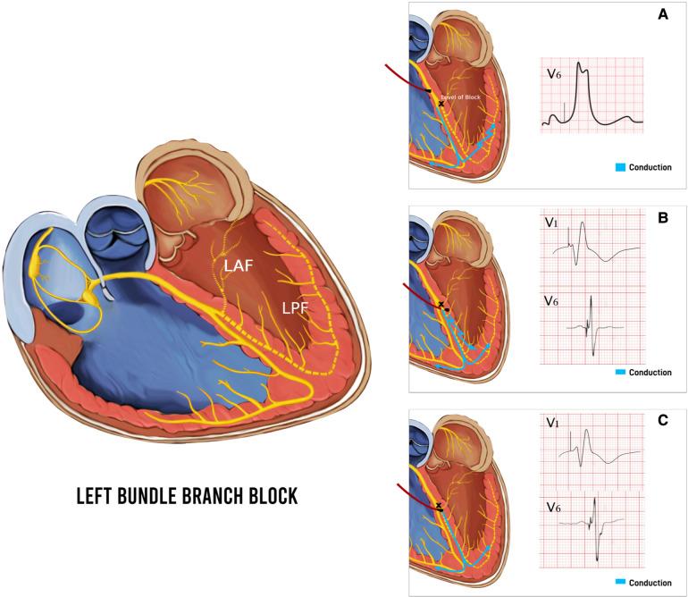 https://cdn.ncbi.nlm.nih.gov/pmc/blobs/14c3/10463741/e08527ed5da6/fcvm-10-1220709-g006.jpg