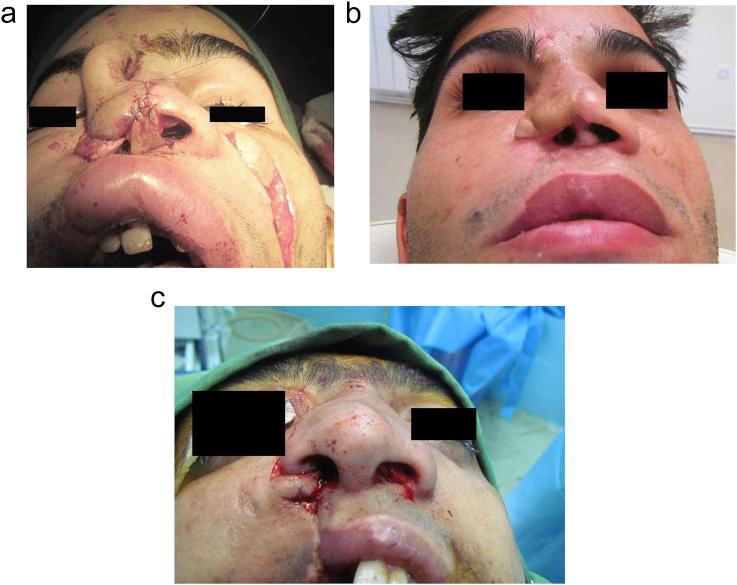 https://cdn.ncbi.nlm.nih.gov/pmc/blobs/14d3/5134091/046832205275/gr7.jpg