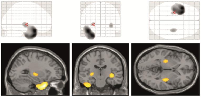https://cdn.ncbi.nlm.nih.gov/pmc/blobs/14d8/4636381/2aeb8ee378c0/pone.0141098.g003.jpg