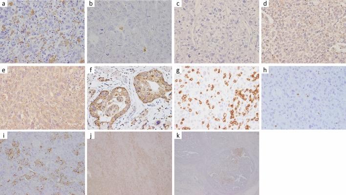 https://cdn.ncbi.nlm.nih.gov/pmc/blobs/14db/11706836/2c3c3959ffcb/10120_2024_1562_Fig2_HTML.jpg