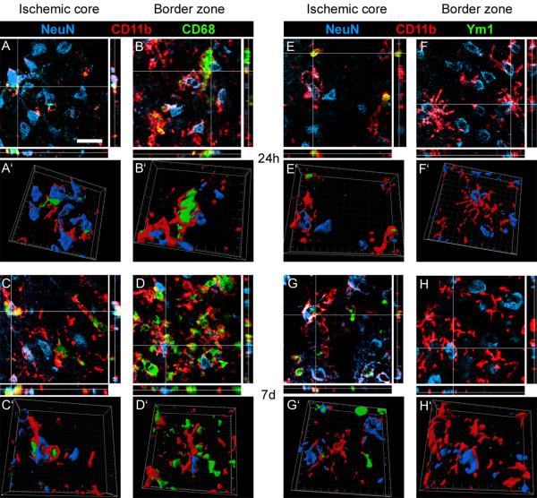 https://cdn.ncbi.nlm.nih.gov/pmc/blobs/14db/3251548/6949980fc2d6/1742-2094-8-174-12.jpg