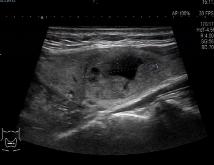 https://cdn.ncbi.nlm.nih.gov/pmc/blobs/14dc/7559667/5e2aca78ea7b/WJCC-8-4681-g002.jpg