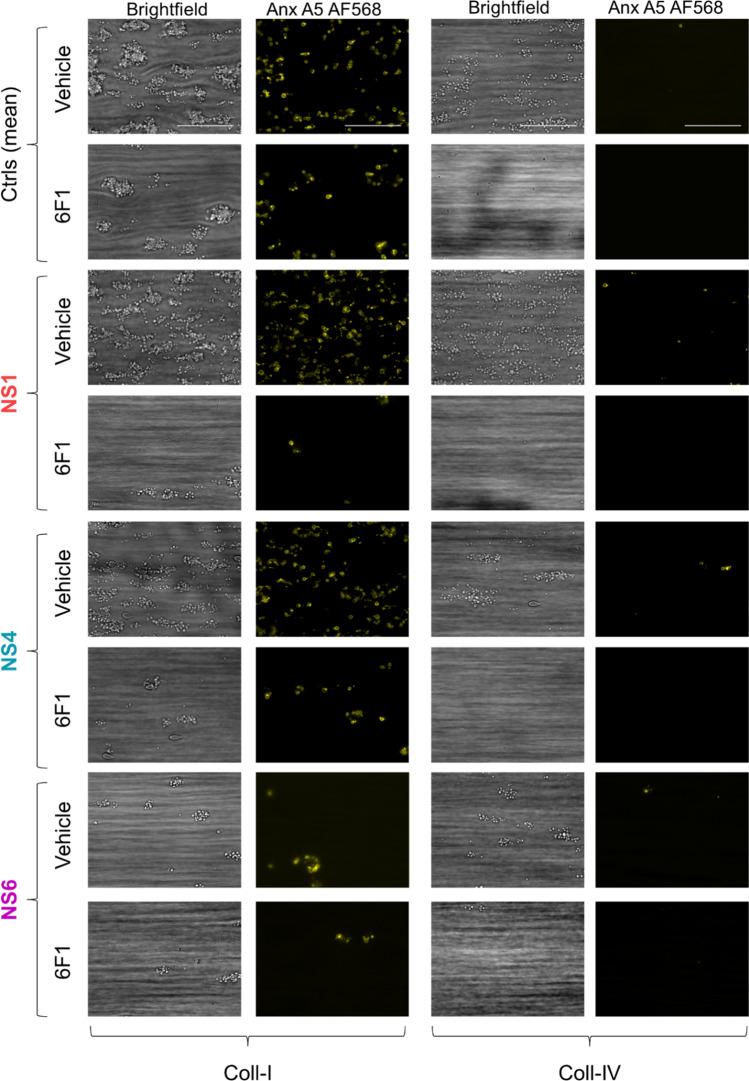 https://cdn.ncbi.nlm.nih.gov/pmc/blobs/14de/11073331/448052b6be0e/18_2023_5058_Fig5_HTML.jpg