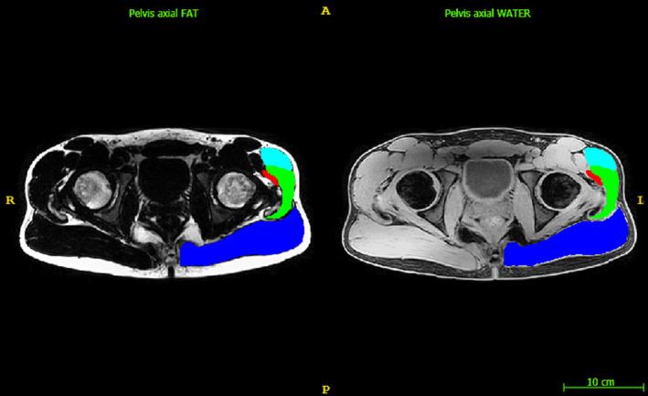 https://cdn.ncbi.nlm.nih.gov/pmc/blobs/14de/11634488/dde511a0f2b8/JCSM-15-2642-g003.jpg