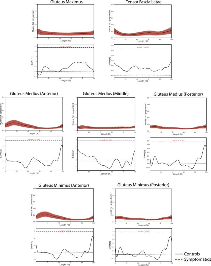 https://cdn.ncbi.nlm.nih.gov/pmc/blobs/14de/11634488/f8164605584f/JCSM-15-2642-g001.jpg