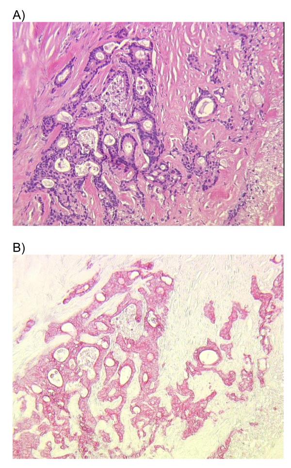 https://cdn.ncbi.nlm.nih.gov/pmc/blobs/14e2/2944157/ff79025f1553/1479-5876-8-83-2.jpg