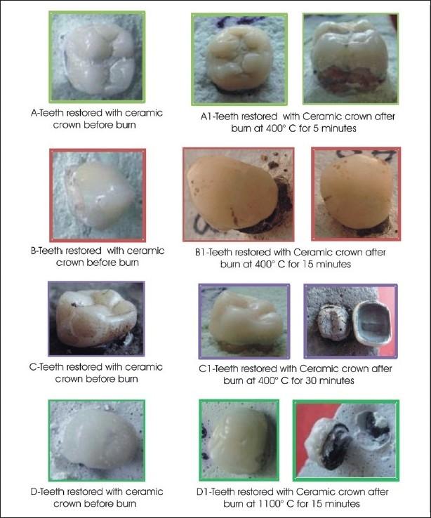 https://cdn.ncbi.nlm.nih.gov/pmc/blobs/14eb/3009553/07e40ed98688/JFDS-2-37-g006.jpg