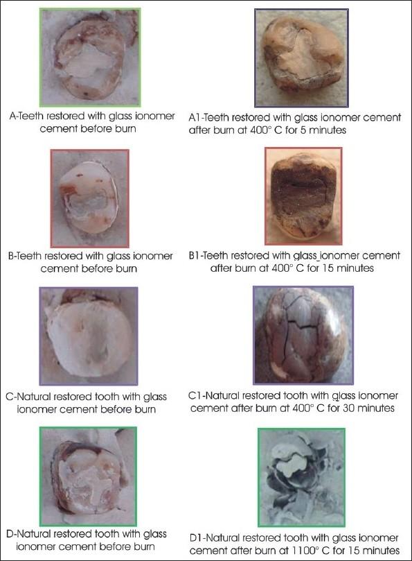 https://cdn.ncbi.nlm.nih.gov/pmc/blobs/14eb/3009553/37cc8a791df5/JFDS-2-37-g004.jpg