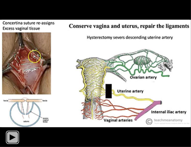 https://cdn.ncbi.nlm.nih.gov/pmc/blobs/14f0/11075963/79a706db74d7/atm-12-02-28-vidS.1.jpg