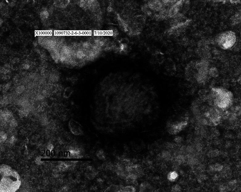 https://cdn.ncbi.nlm.nih.gov/pmc/blobs/14f0/9412069/56aae72ca929/jvms-84-1093-g004.jpg