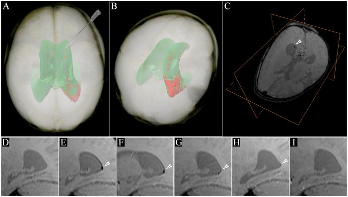 https://cdn.ncbi.nlm.nih.gov/pmc/blobs/14f1/4053317/334035d2a44d/pone.0097631.g001.jpg