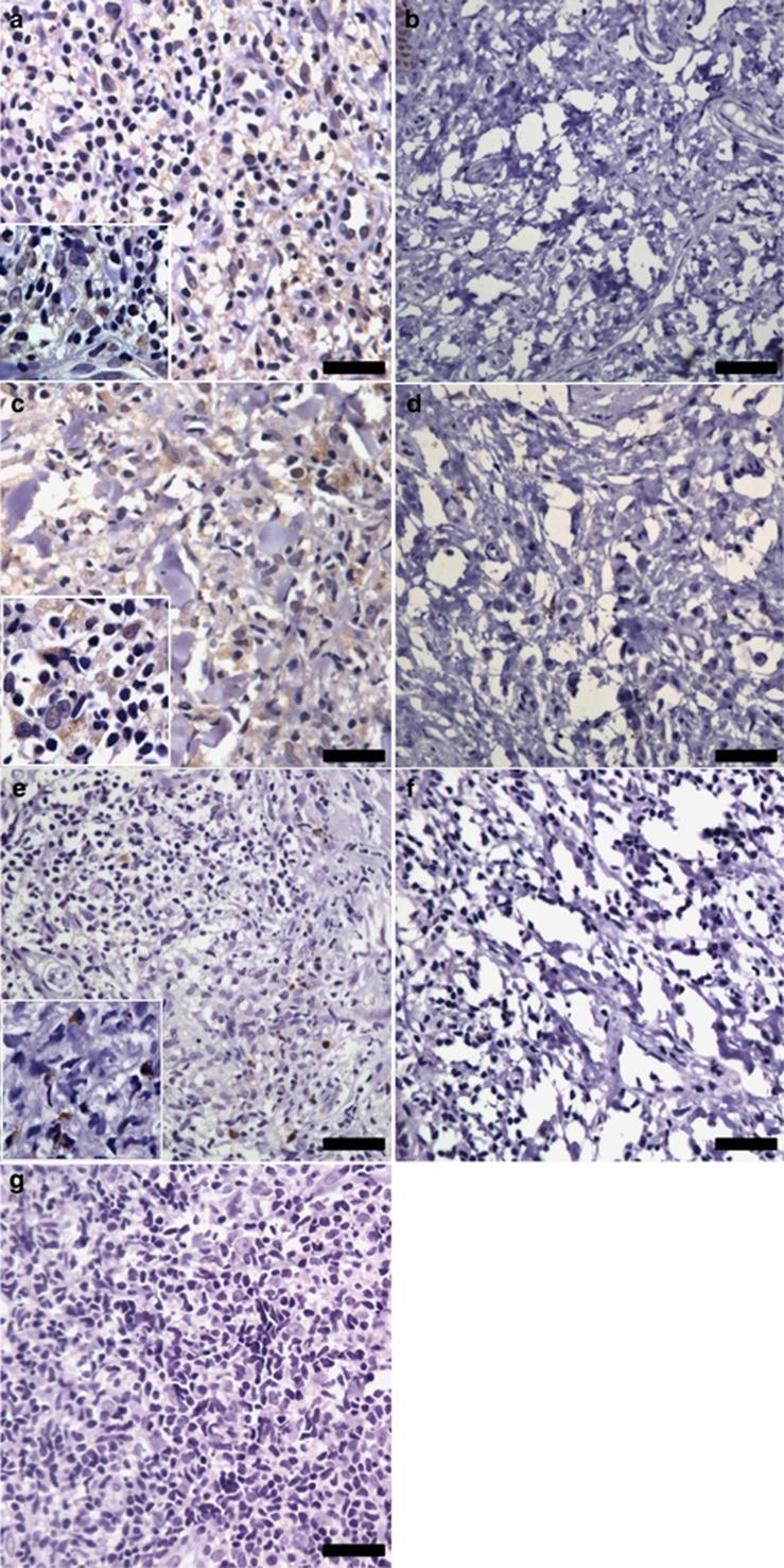 https://cdn.ncbi.nlm.nih.gov/pmc/blobs/14f2/4291685/8ec9e4735895/jid2014396f4.jpg