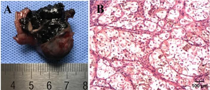 https://cdn.ncbi.nlm.nih.gov/pmc/blobs/14fc/12170223/960a717548cd/CCR3-13-e70507-g007.jpg