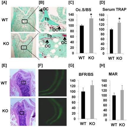 https://cdn.ncbi.nlm.nih.gov/pmc/blobs/14fc/3293909/585ea4a667e3/pone.0032887.g005.jpg