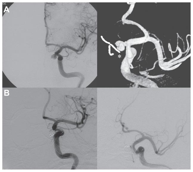 https://cdn.ncbi.nlm.nih.gov/pmc/blobs/1504/3565560/1c3959679525/cmar-5-021f3.jpg