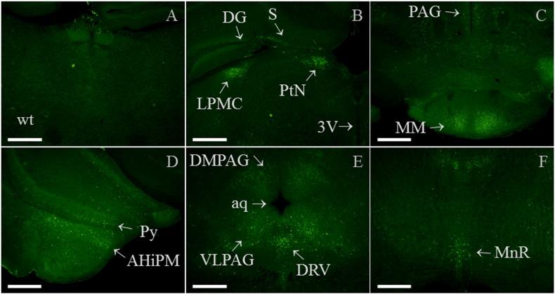 https://cdn.ncbi.nlm.nih.gov/pmc/blobs/1504/4604734/745182602da9/gr14.jpg