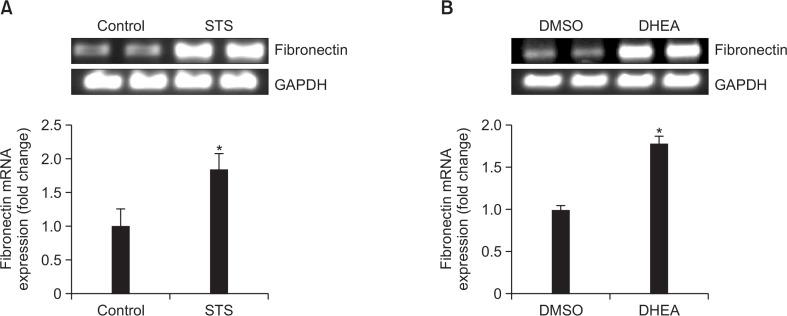 https://cdn.ncbi.nlm.nih.gov/pmc/blobs/1506/5424643/c0dfcf45214f/bt-25-321f3.jpg