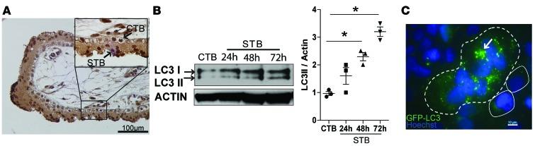 https://cdn.ncbi.nlm.nih.gov/pmc/blobs/1509/5161251/817a4861cdb6/jciinsight-1-86654-g002.jpg