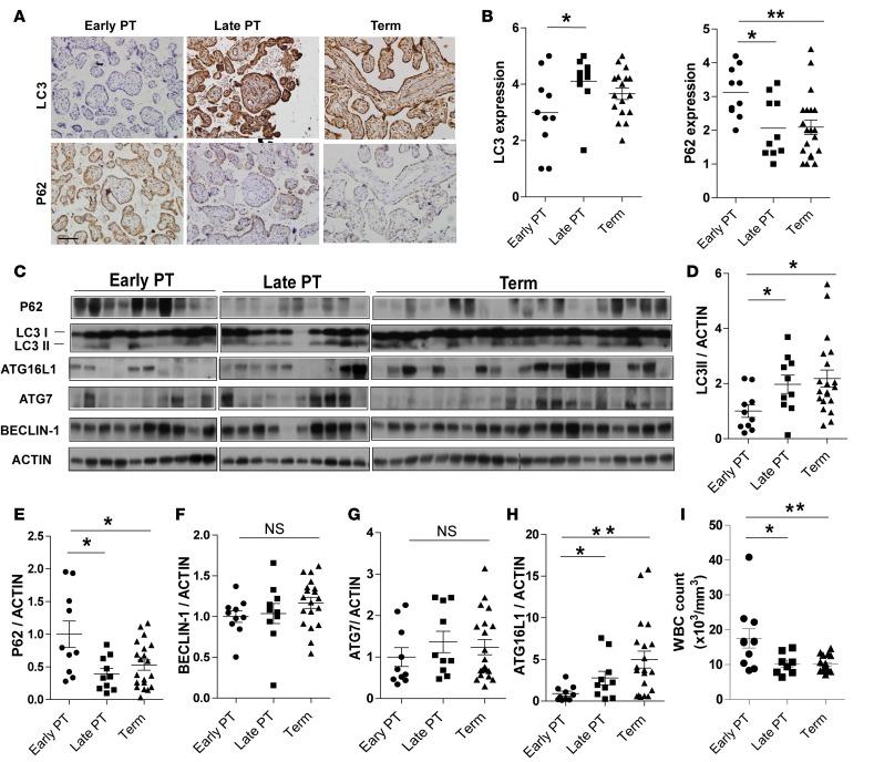 https://cdn.ncbi.nlm.nih.gov/pmc/blobs/1509/5161251/d9d70af1852c/jciinsight-1-86654-g001.jpg