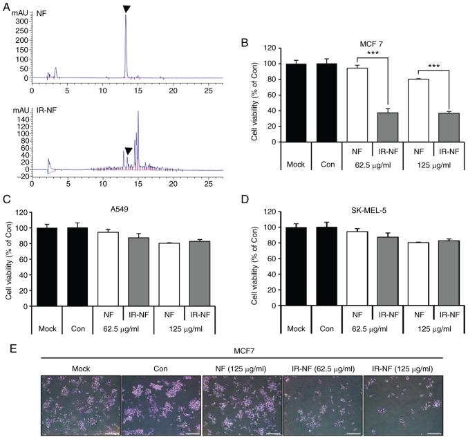 https://cdn.ncbi.nlm.nih.gov/pmc/blobs/150b/8931636/296de6c1691e/etm-23-04-11235-g00.jpg