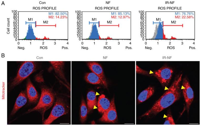 https://cdn.ncbi.nlm.nih.gov/pmc/blobs/150b/8931636/e2bf0676e934/etm-23-04-11235-g02.jpg