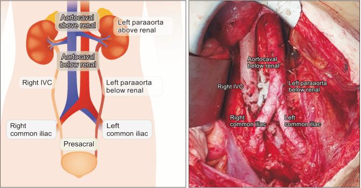 https://cdn.ncbi.nlm.nih.gov/pmc/blobs/1511/10648615/6aa29d3176f2/astr-105-271-g001.jpg