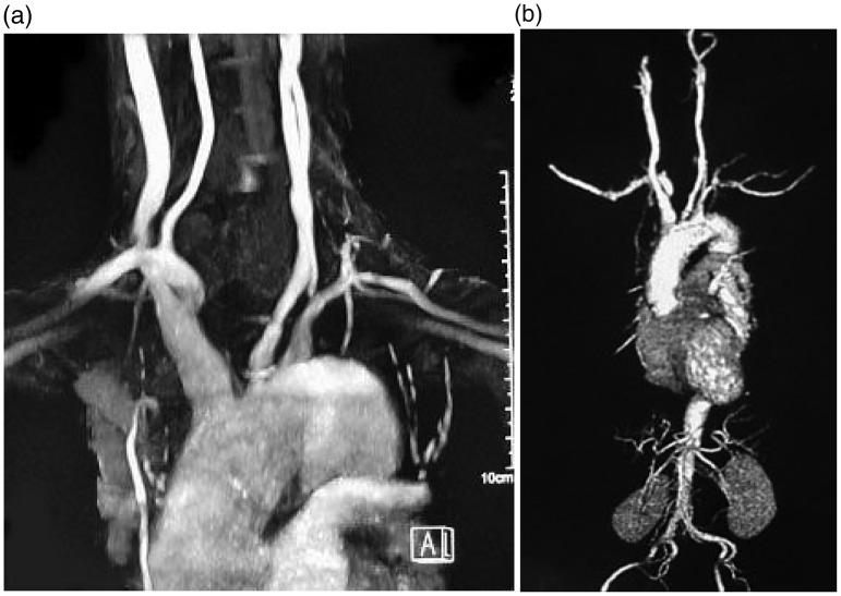 https://cdn.ncbi.nlm.nih.gov/pmc/blobs/1515/6023039/68d887ccf066/10.1177_0300060518769548-fig2.jpg