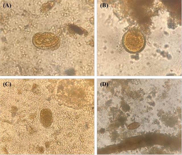 https://cdn.ncbi.nlm.nih.gov/pmc/blobs/1517/10787631/4c18cb6db28f/j_helm-2023-0037_fig_002.jpg