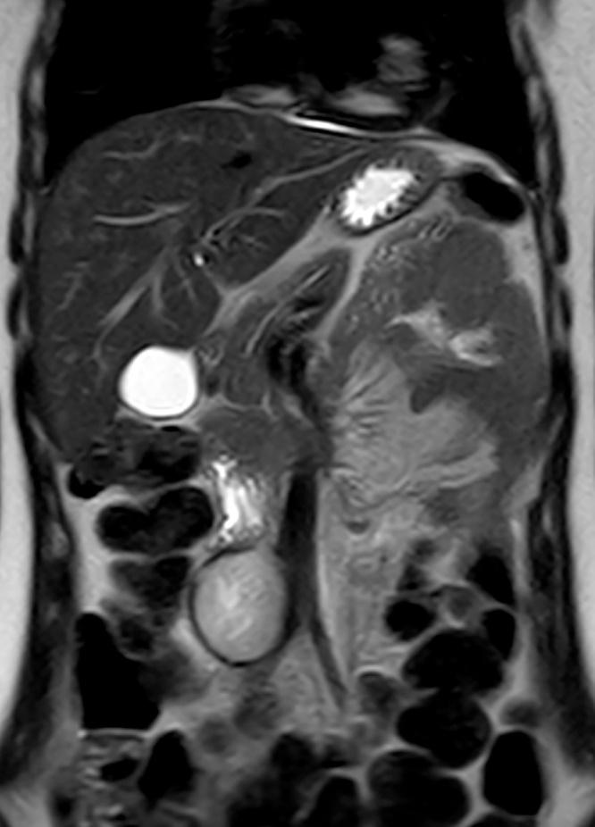https://cdn.ncbi.nlm.nih.gov/pmc/blobs/151a/5554985/52bb5c0dde3d/gr2.jpg